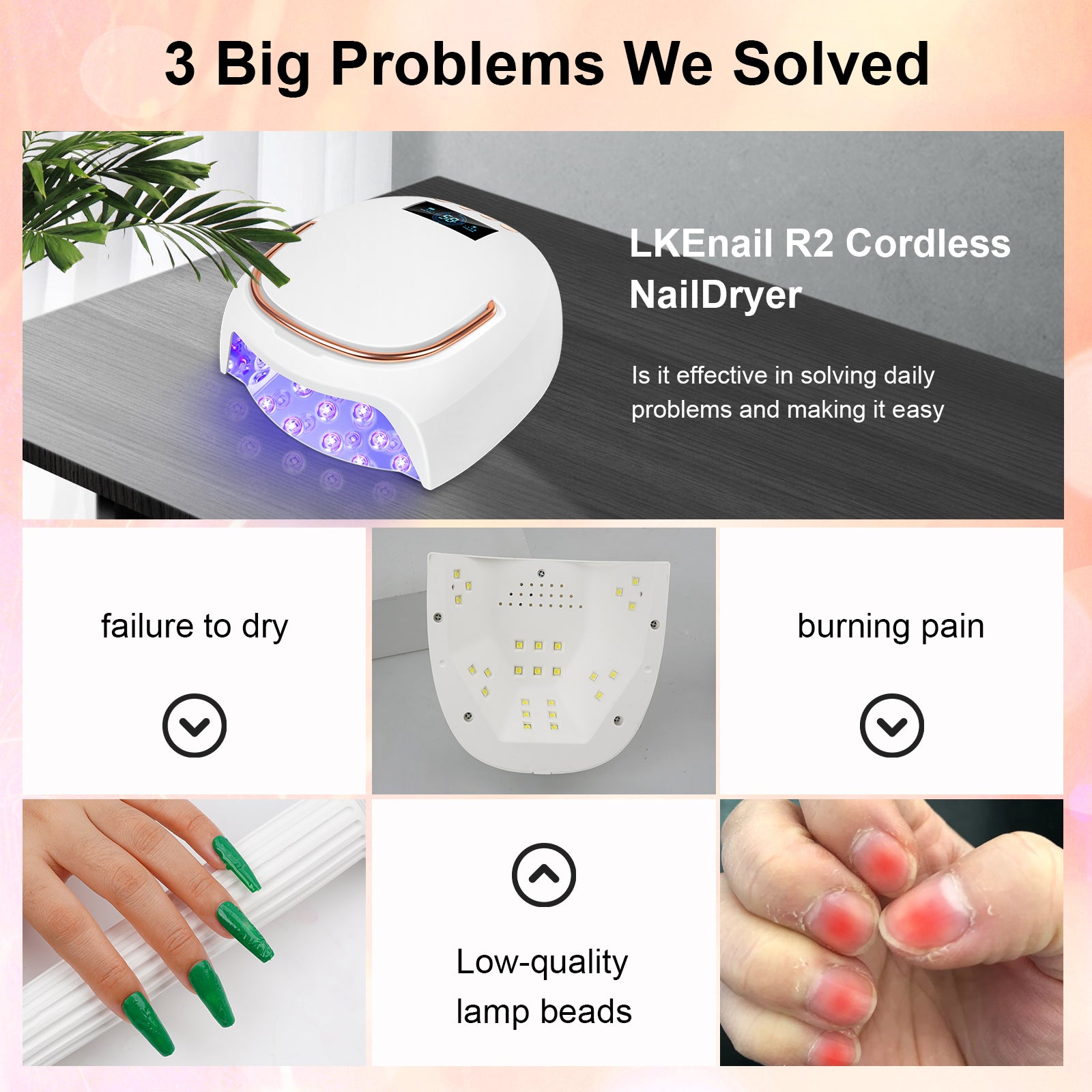 Shexnail R2 TimeFlex